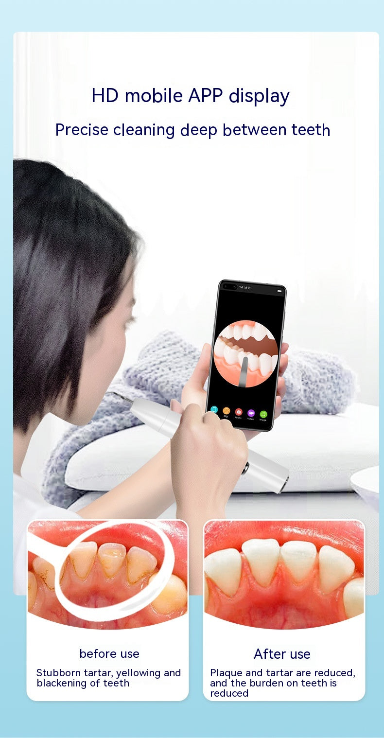 Professional Ultrasonic Dental Cleaner for Safe Home Use