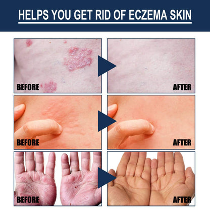 Natural Skin Repair Spray – Crumps, Allergy, Swelling & Eczema