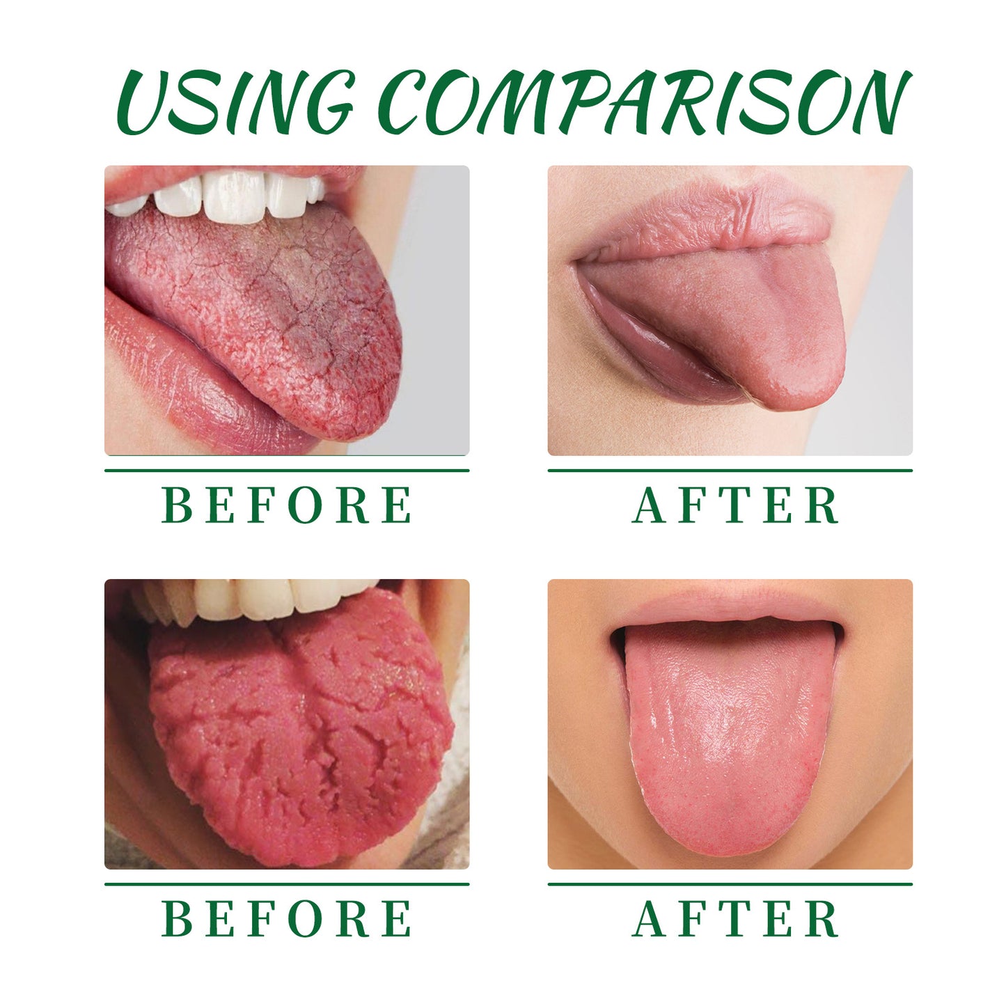 Organic Tongue Repair Oral Spray for Healthy Comfy Mouth