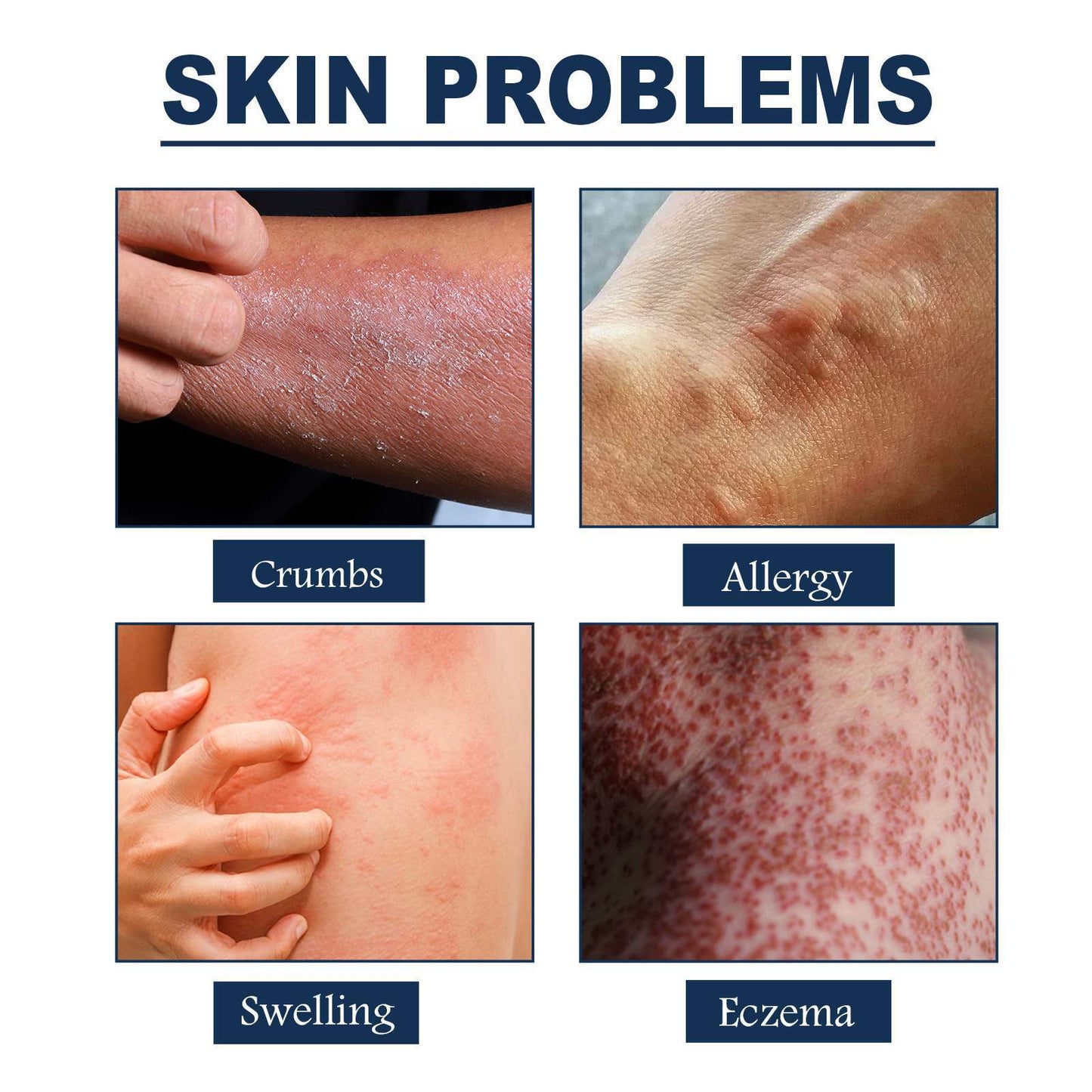 Natural Skin Repair Spray – Crumps, Allergy, Swelling & Eczema