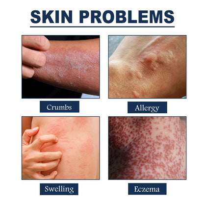 Natural Skin Repair Spray – Crumps, Allergy, Swelling & Eczema