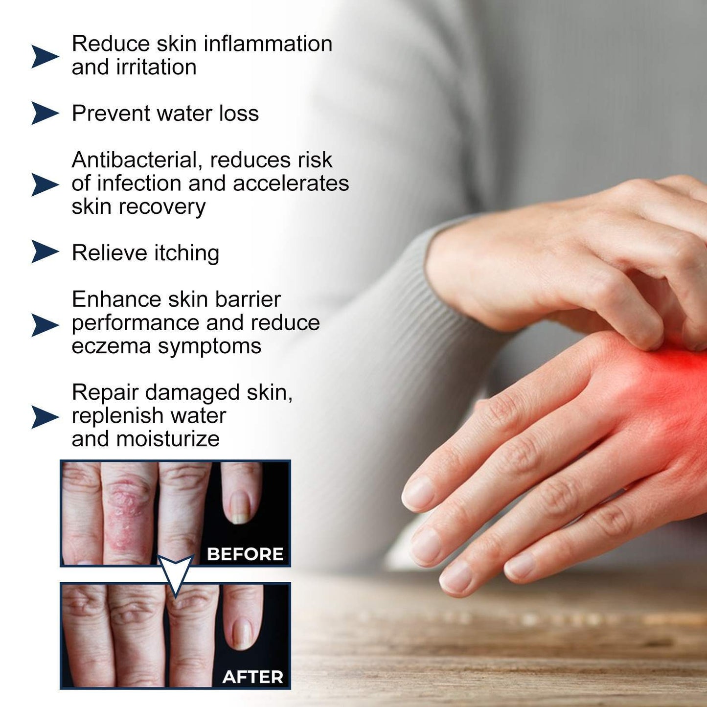 Natural Skin Repair Spray – Crumps, Allergy, Swelling & Eczema