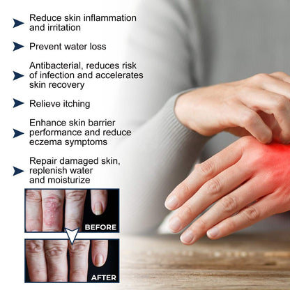 Natural Skin Repair Spray – Crumps, Allergy, Swelling & Eczema